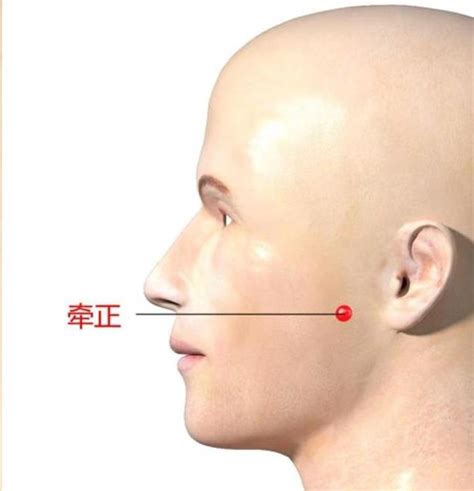 牽正穴|牽正